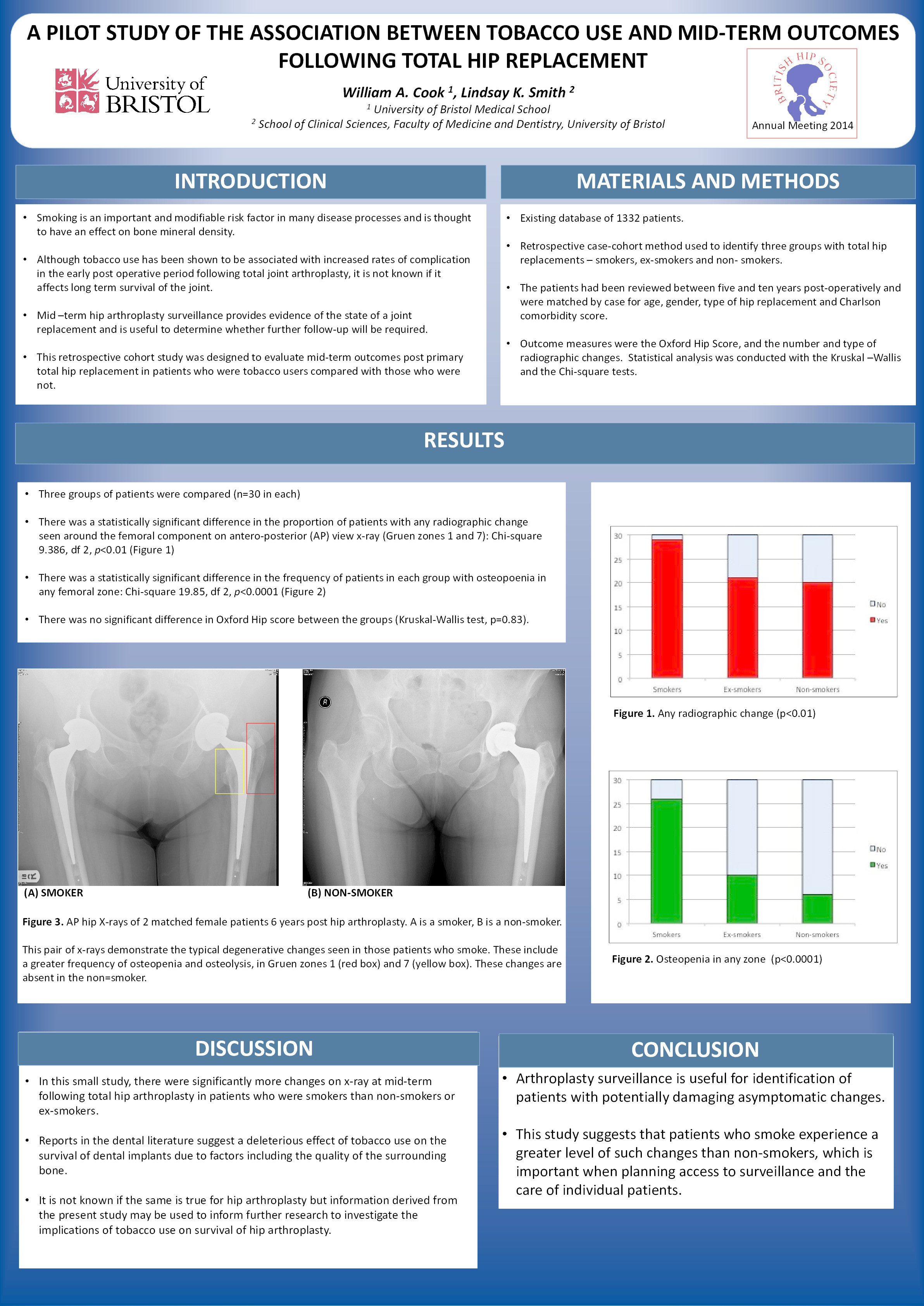 A pilot study of the association between tobacco use and mid-term outcomes following total hip replacement Thumbnail