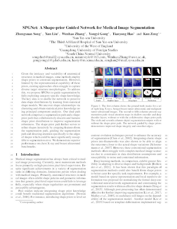 SPGNet: A shape-prior guided network for medical image segmentation Thumbnail