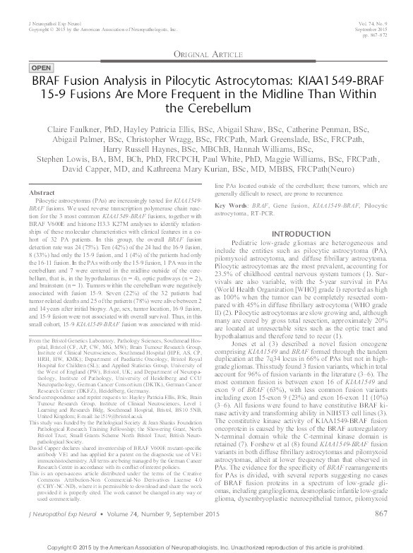 BRAF Fusion Analysis in Pilocytic Astrocytomas: KIAA1549-BRAF 15-9 Fusions Are More Frequent in the Midline Than Within the Cerebellum Thumbnail